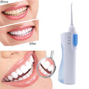 Animore Portable Oral Irrigator Tooth Cleaner - White