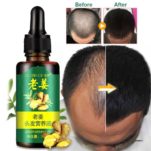 30ml Hair Growth Essence Effective Scalp Nutritious Repair Oil