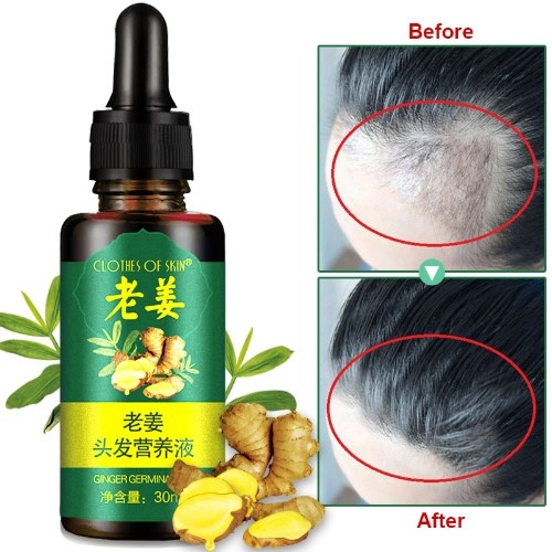 30ml Hair Growth Essence Effective Scalp Nutritious Repair Oil